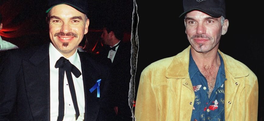 billy-bob-thornton-before-after