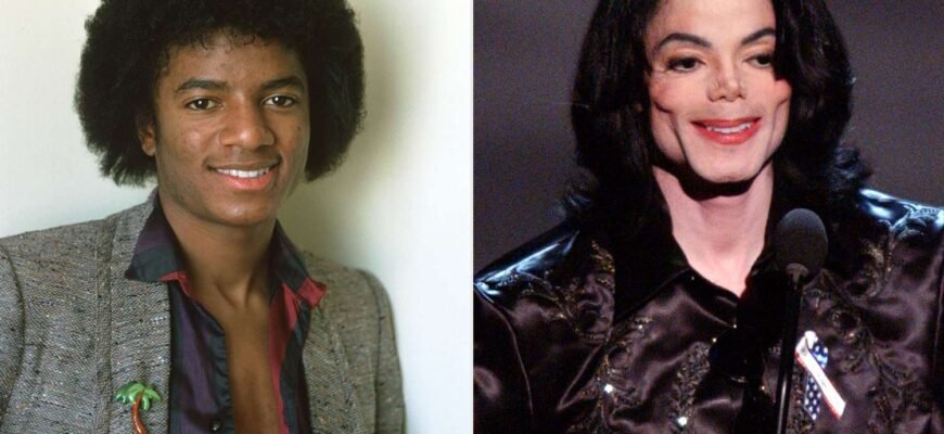 michael-jackson-plastic-surgery-042726-5f0efa3f5eb246a79fb1a7b2fa3e8496
