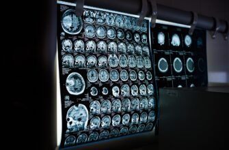 how-does-an-mri-work-technology-and-procedure