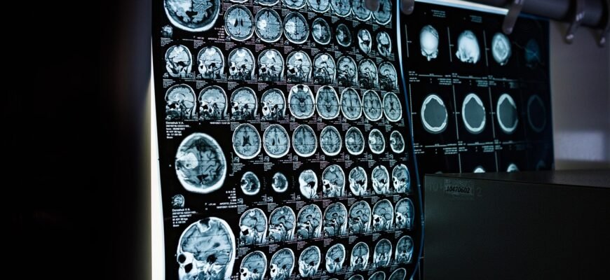 how-does-an-mri-work-technology-and-procedure