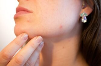 how-does-canker-sore-form-causes-and-treatment
