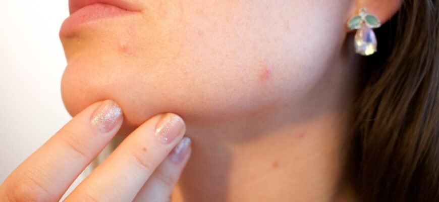 how-does-canker-sore-form-causes-and-treatment