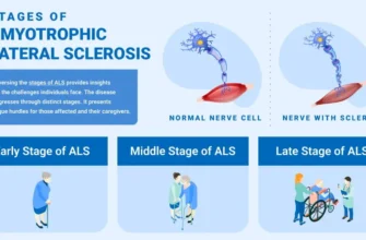 meaning-of-als-disease-symptoms-and-progression