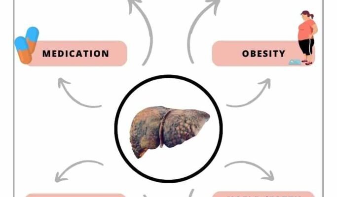 meaning-of-high-liver-enzymes-causes-and-next-steps