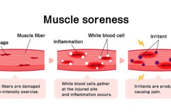 meaning-of-soreness-causes-and-muscle-recovery