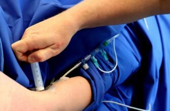 what-is-venous-deficiency-symptoms-and-treatment